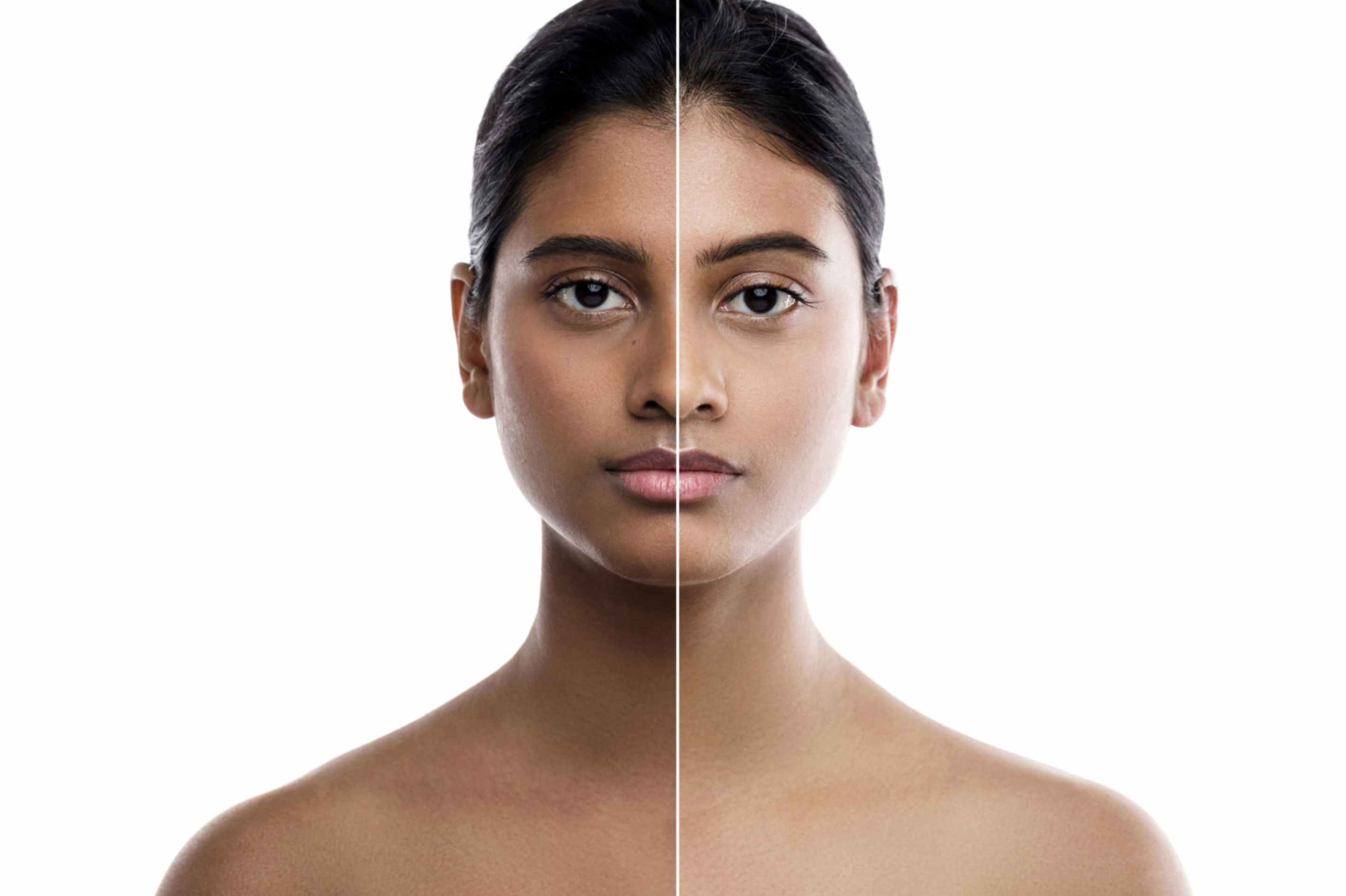 Skin xperts Super speciality Skin,Hair and Laser Clinics - Latest update - Where can I get skin whitening treatment in Bangalore?