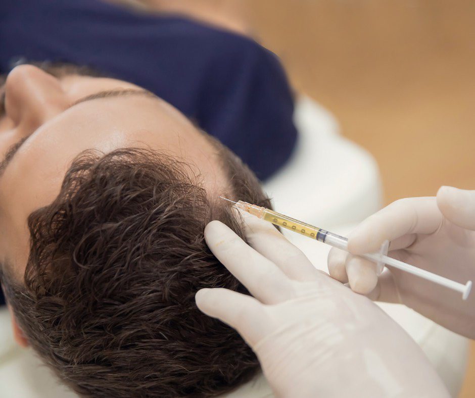 Skin xperts Super speciality Skin,Hair and Laser Clinics - Latest update - Affordable PRP Hair Treatment Near Rajajinagar