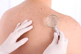 Skin xperts Super speciality Skin,Hair and Laser Clinics - Album - Dermatologists Clinic in Bangalore