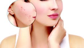 Skin xperts Super speciality Skin,Hair and Laser Clinics - Latest update - Dull Skin Treatment in Rajajinagar