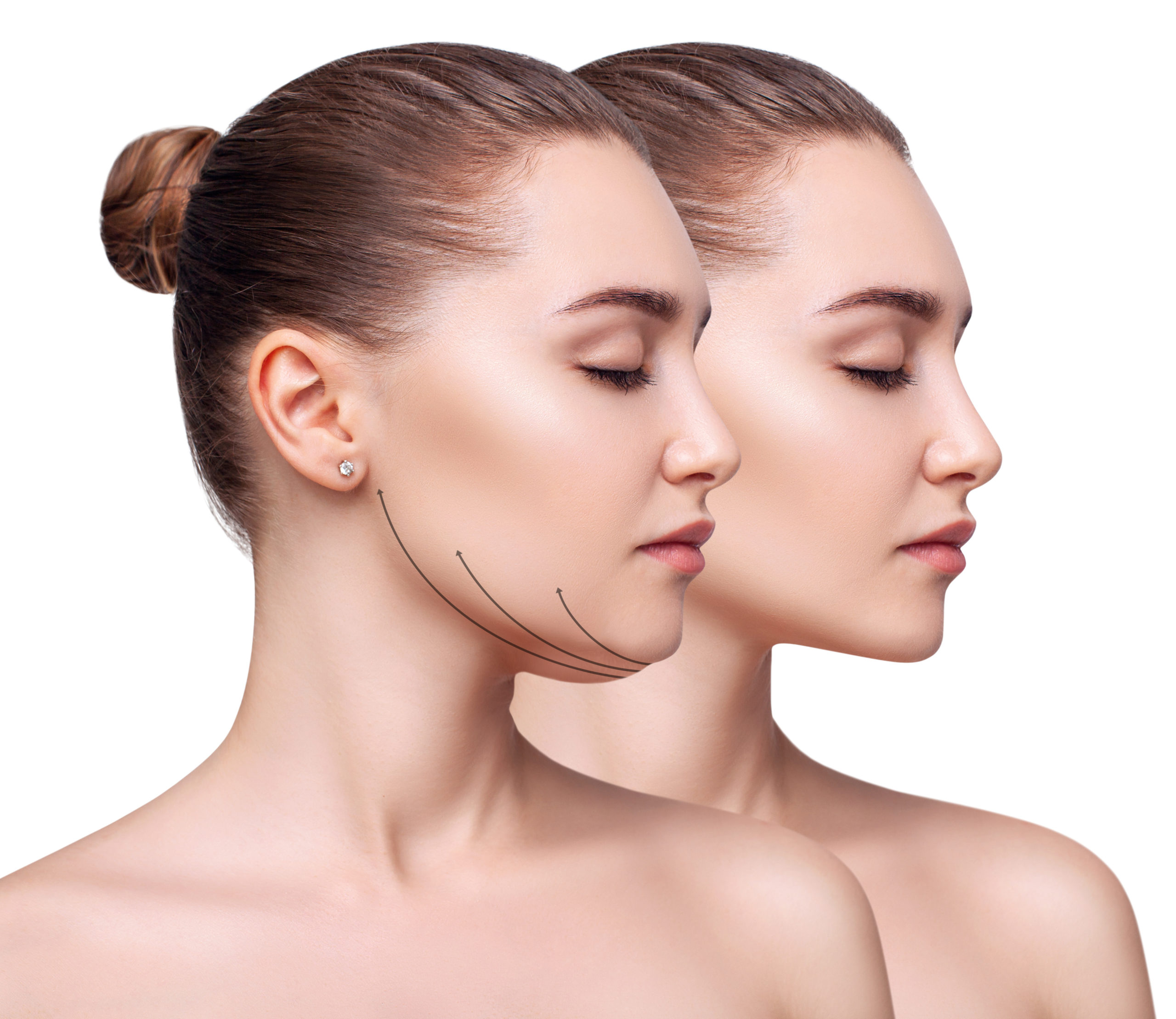 Skin xperts Super speciality Skin,Hair and Laser Clinics - Latest update - Permanent Skin Tightening Treatment near Jayanagar