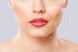 Skin xperts Super speciality Skin,Hair and Laser Clinics - Latest update - Dermatologists In Bangalore