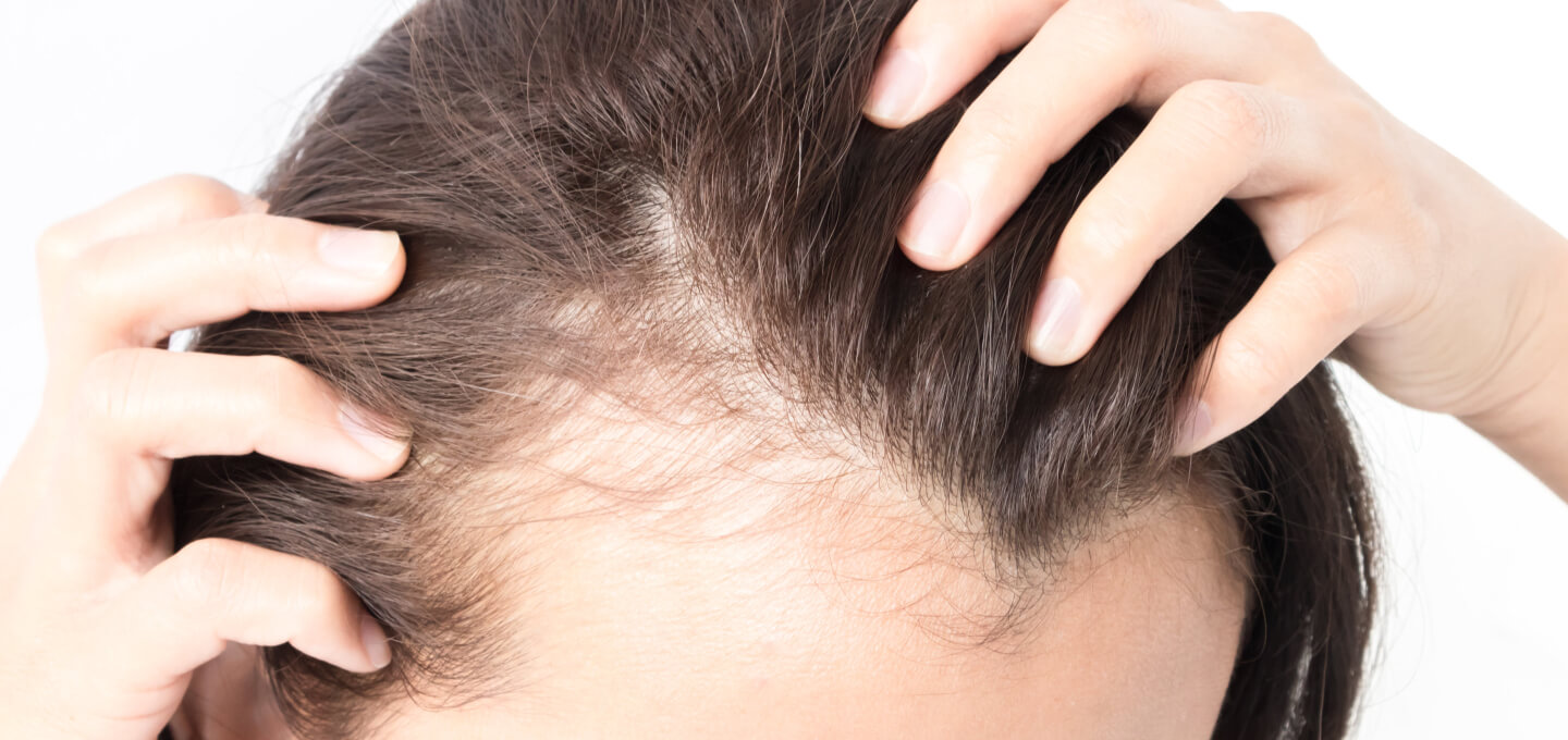 Skin xperts Super speciality Skin,Hair and Laser Clinics - Latest update - Hair Loss Specialist in Kengeri