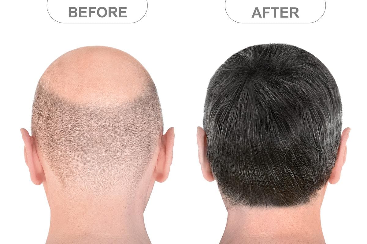 Skin xperts Super speciality Skin,Hair and Laser Clinics - Latest update - Hair Transplant Clinic Near Rajajinagar